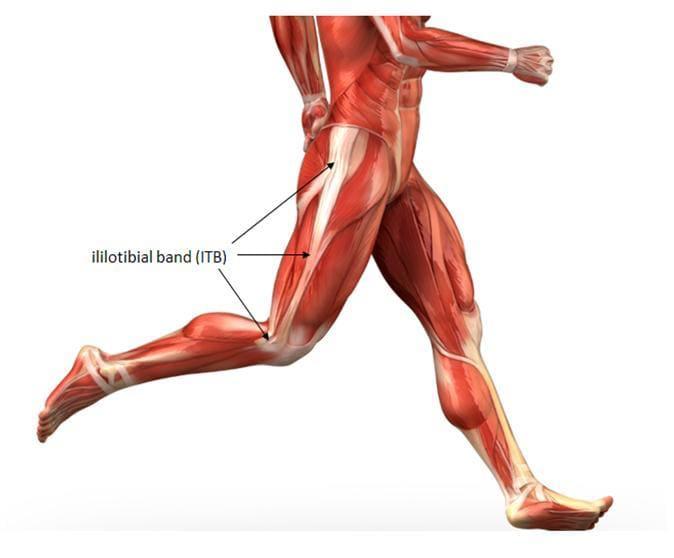 ITB Friction Syndrome: By Lisa Posnett (Pure Sports Medicine)